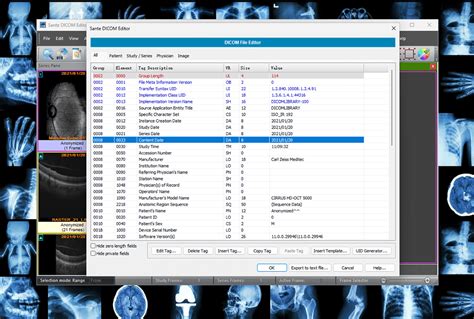 Sante DICOM Editor 10.1.2